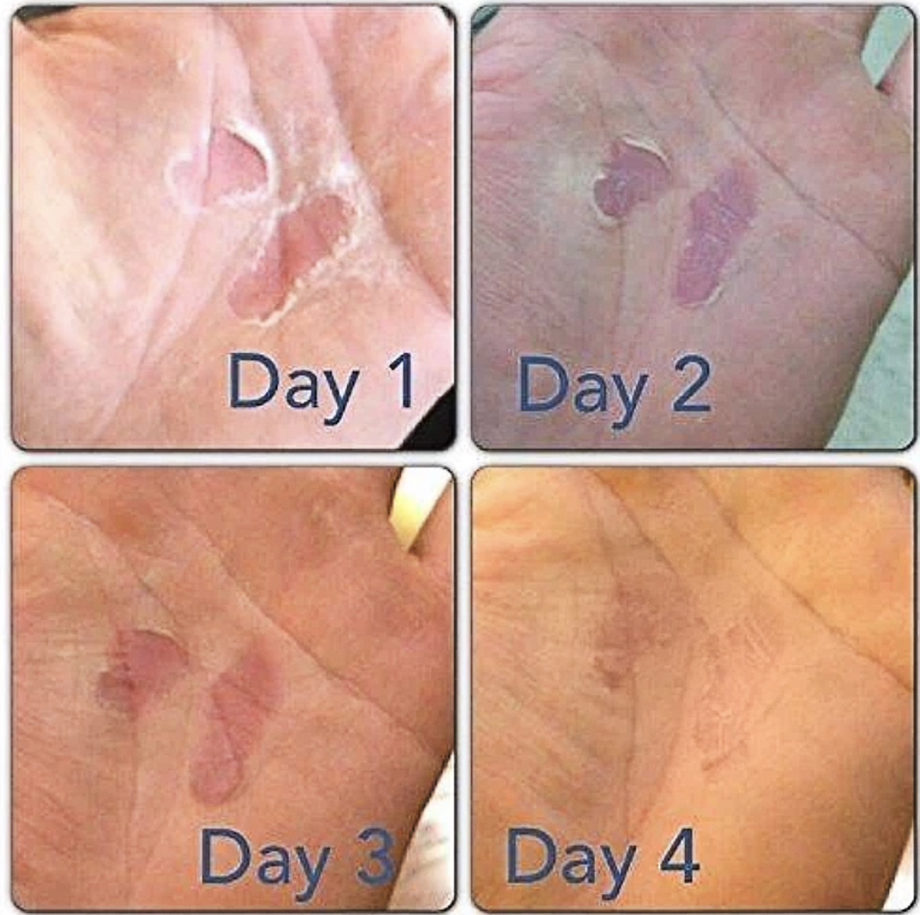 Rip Fix Græðandi Krem